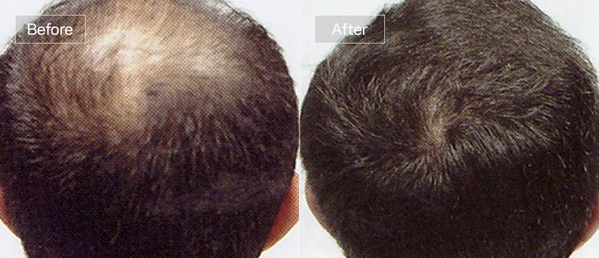 /filedata/md_board/20260102161108_7kDbZU0g_sub1_slide1.jpg 전후사진