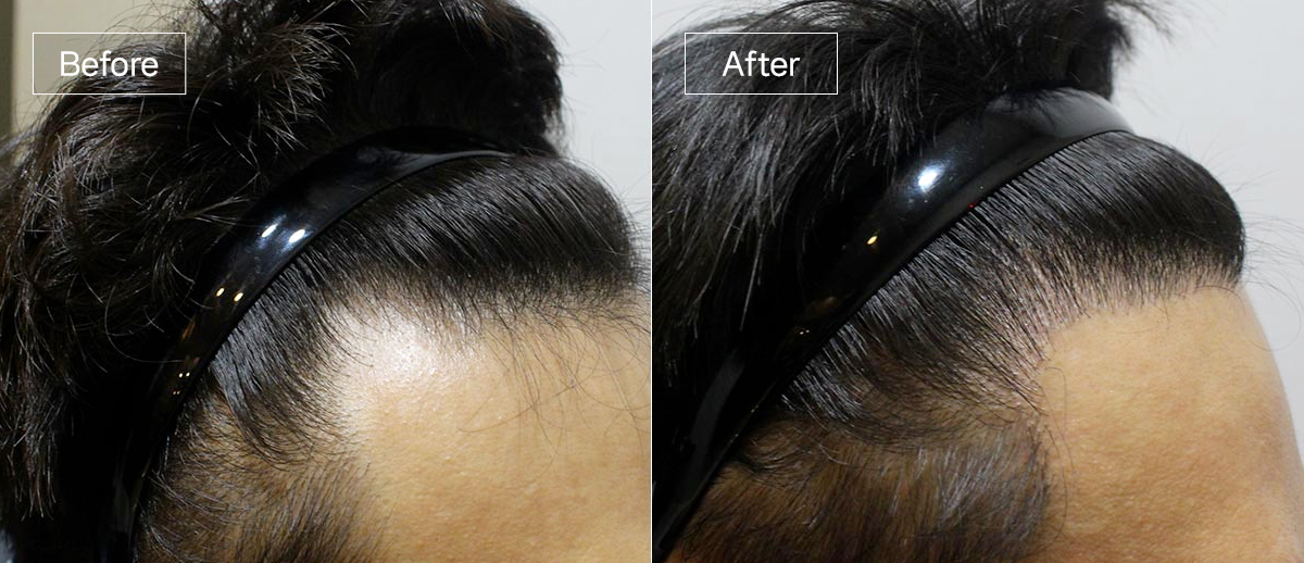 /filedata/md_board/20260102161439_TmBdQXxV_sub1_slide5.jpg 전후사진