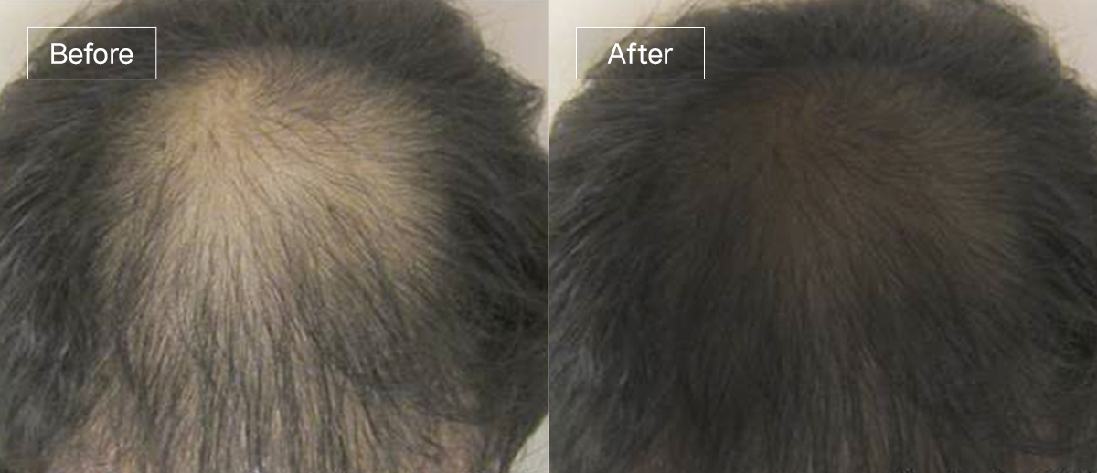 /filedata/md_board/20260102161700_jTZ0PrfY_slide1.jpg 전후사진