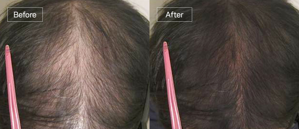 /filedata/md_board/20260102161706_5VeXbhFP_slide2.jpg 전후사진