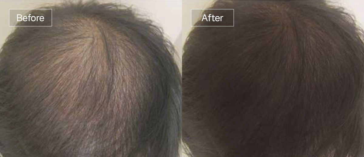 /filedata/md_board/20260102161713_XZB5fr76_slide3.jpg 전후사진