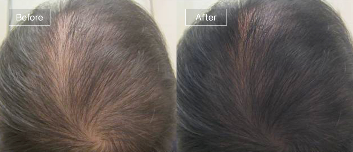 /filedata/md_board/20260102161719_1te2JpHP_slide4.jpg 전후사진