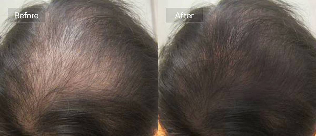 /filedata/md_board/20260102161725_yDnZdSJe_slide5.jpg 전후사진