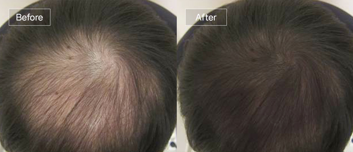 /filedata/md_board/20260102161731_fg4EMvFK_slide6.jpg 전후사진