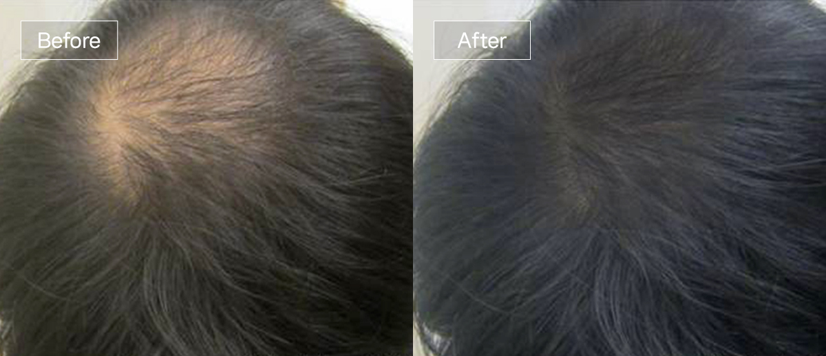 /filedata/md_board/20260102161744_SxBlIgu9_slide8.jpg 전후사진