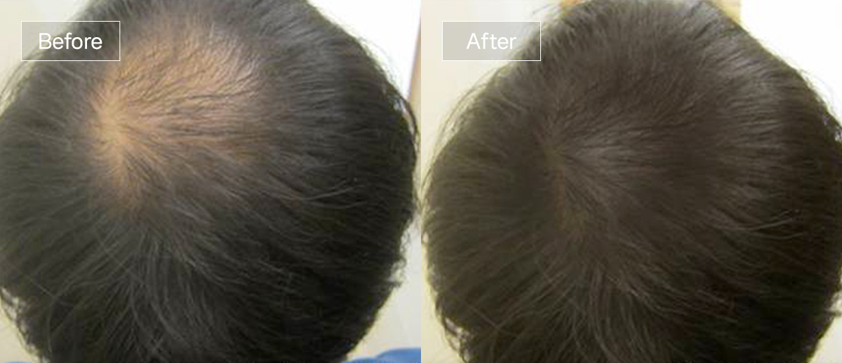 /filedata/md_board/20260102161751_kAKqnpUd_slide9.jpg 전후사진