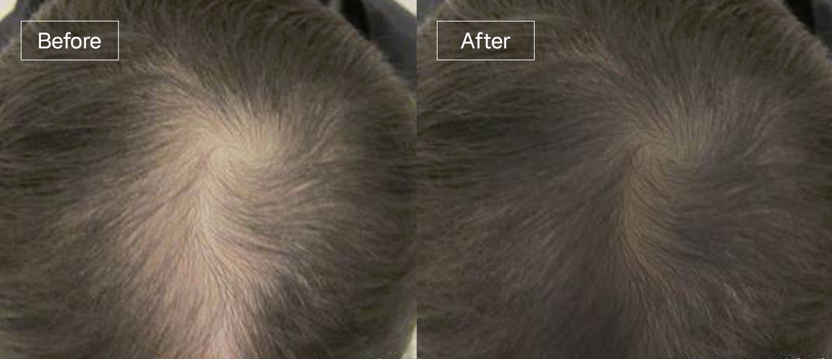 /filedata/md_board/20260102161829_k3ZRQCgN_slide12.jpg 전후사진