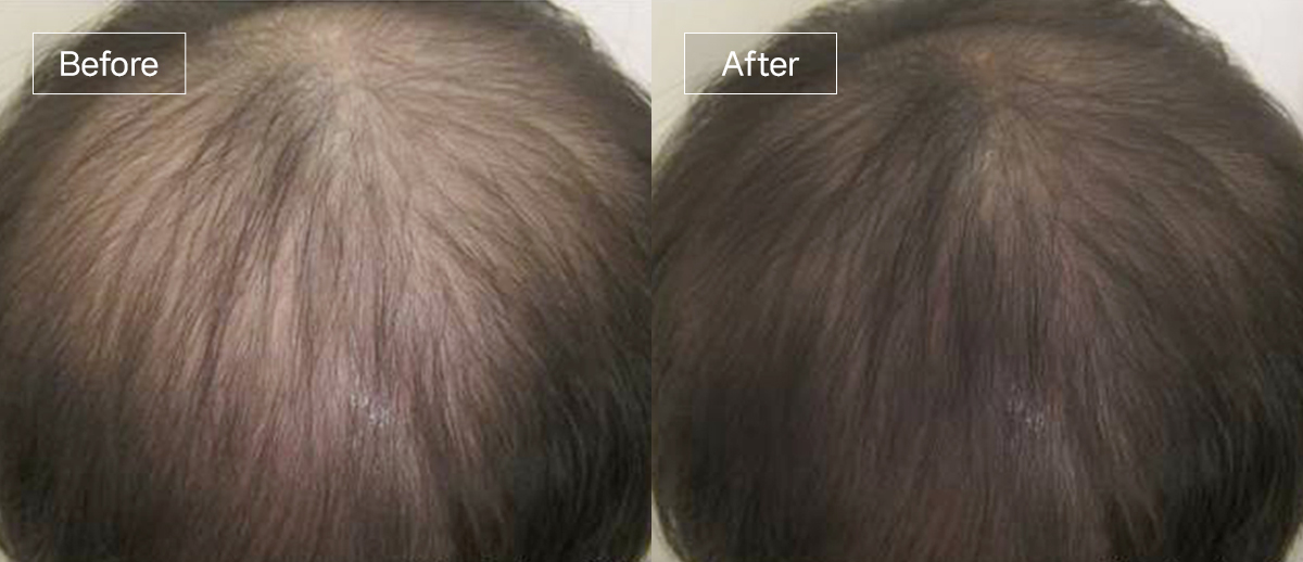 /filedata/md_board/20260102161841_Wpbk6mVY_slide14.jpg 전후사진