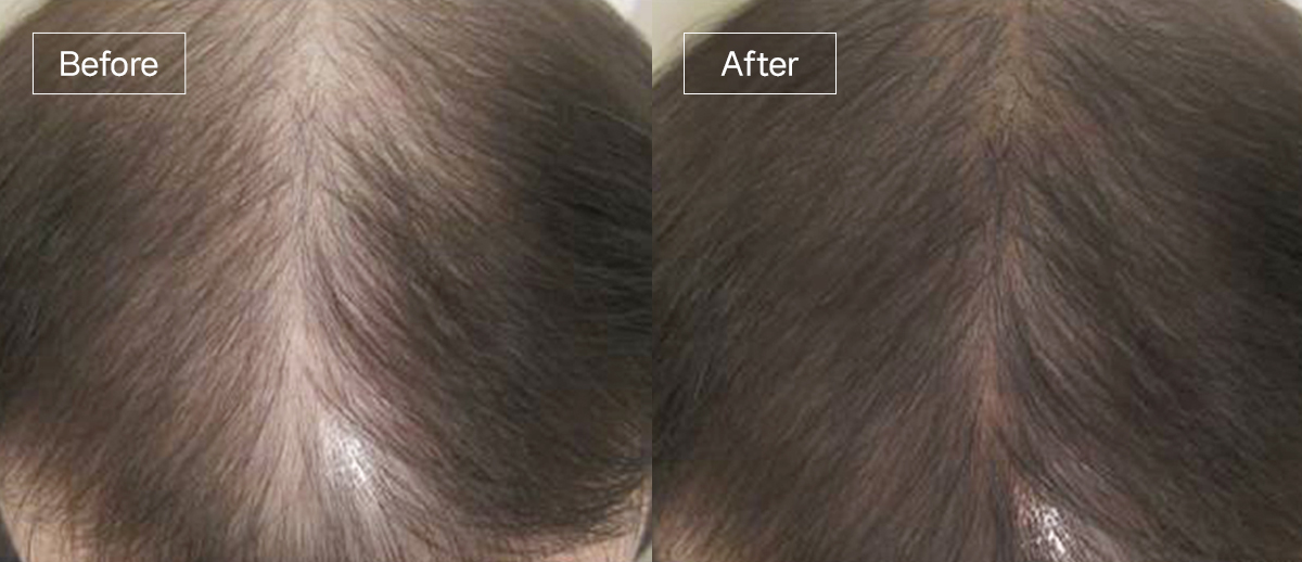 /filedata/md_board/20260102161848_SgN9boC1_slide15.jpg 전후사진