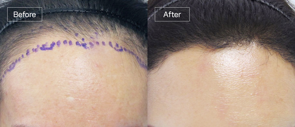 /filedata/md_board/20260102162047_DyxG3Zf2_sub3_slide6.jpg 전후사진