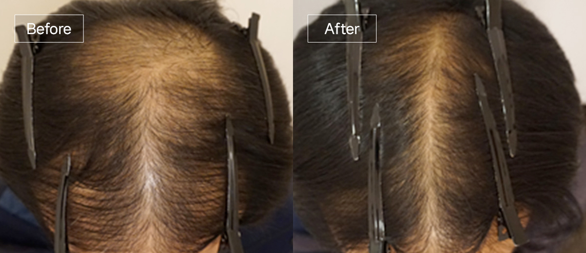 /filedata/md_board/20260102162213_DNyFgSab_sub4_slide1.jpg 전후사진