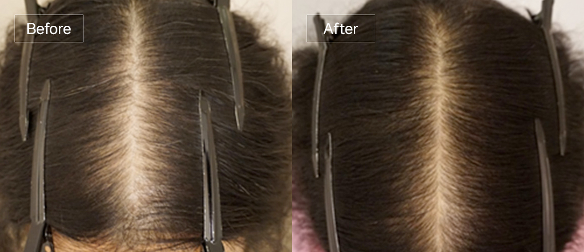 /filedata/md_board/20260102162226_VPS9tekz_sub4_slide3.jpg 전후사진