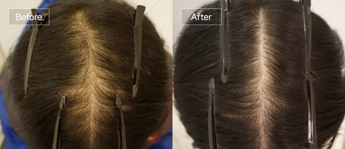 /filedata/md_board/20260102162232_bRHxvWf7_sub4_slide4.jpg 전후사진